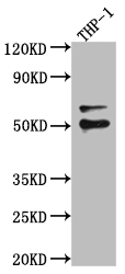 FLI1 Recombinant Monoclonal Antibody [4E5] (100µl)