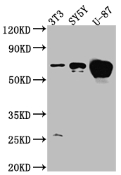 ESR1 Recombinant Monoclonal Antibody [3H8] (100µl)