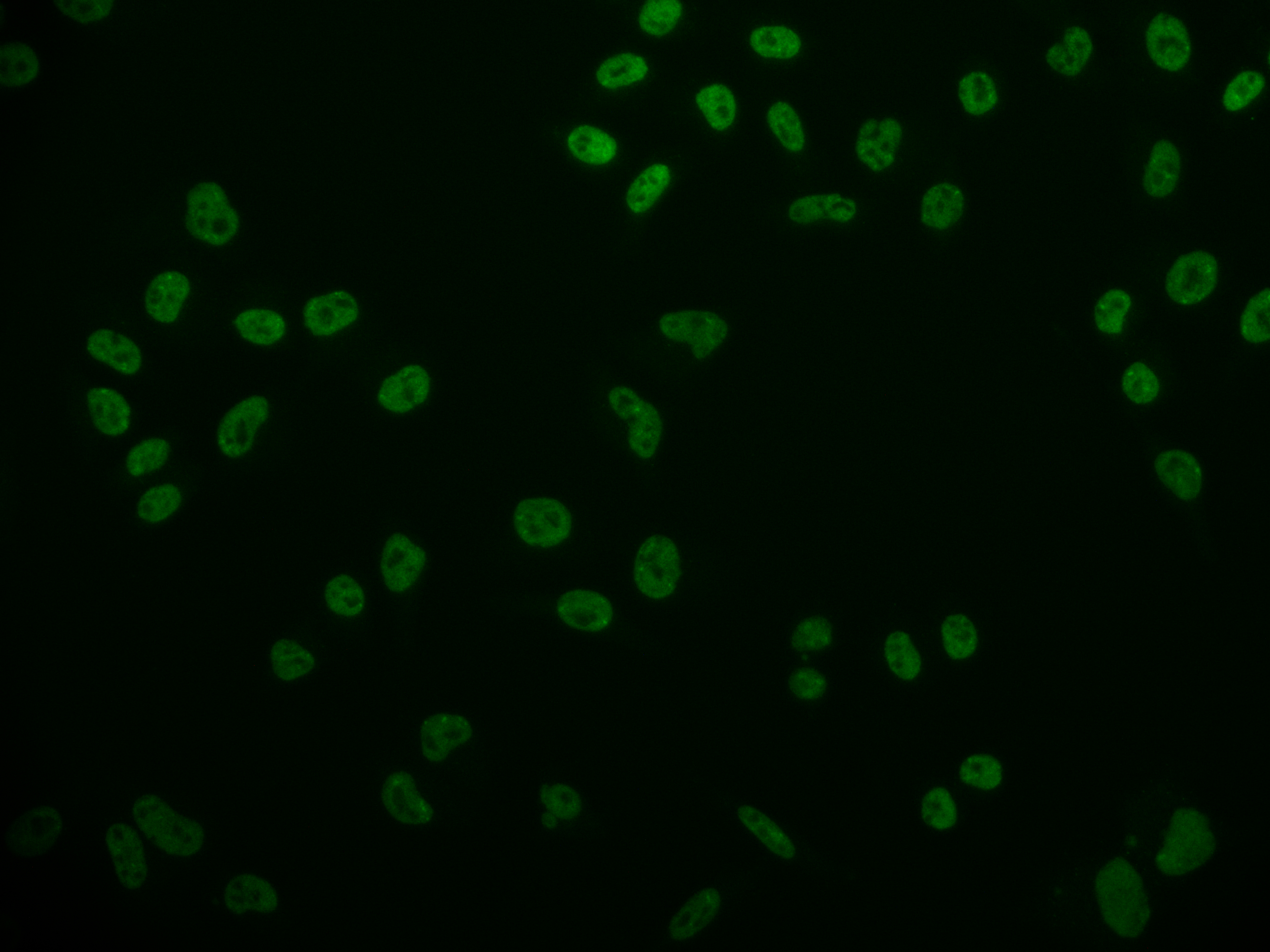 CDX1 Recombinant Monoclonal Antibody [11E10] (50µl)