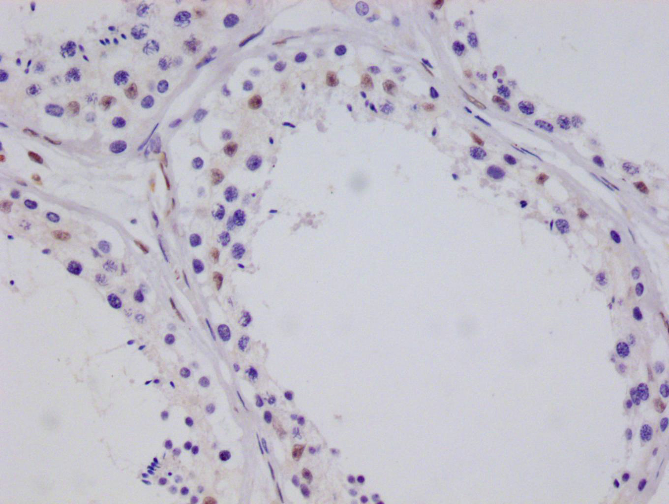 CRTC3 Recombinant Monoclonal Antibody [10G3] (100µl)