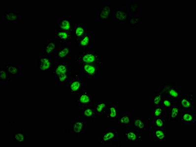 HDAC9 Recombinant Monoclonal Antibody [1F2] (100µl)