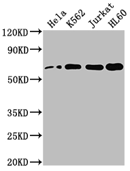 HDAC1 Recombinant Monoclonal Antibody [10A1] (100µl)