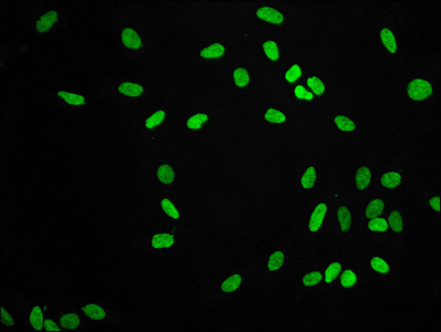 Histone H3.1K9me2 Recombinant Monoclonal Antibody [1A10] (100µl)