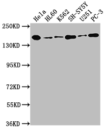 DOT1L Recombinant Monoclonal Antibody [3B6] (100µl)
