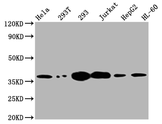 TYMS Recombinant Monoclonal Antibody [2B2] (100µl)