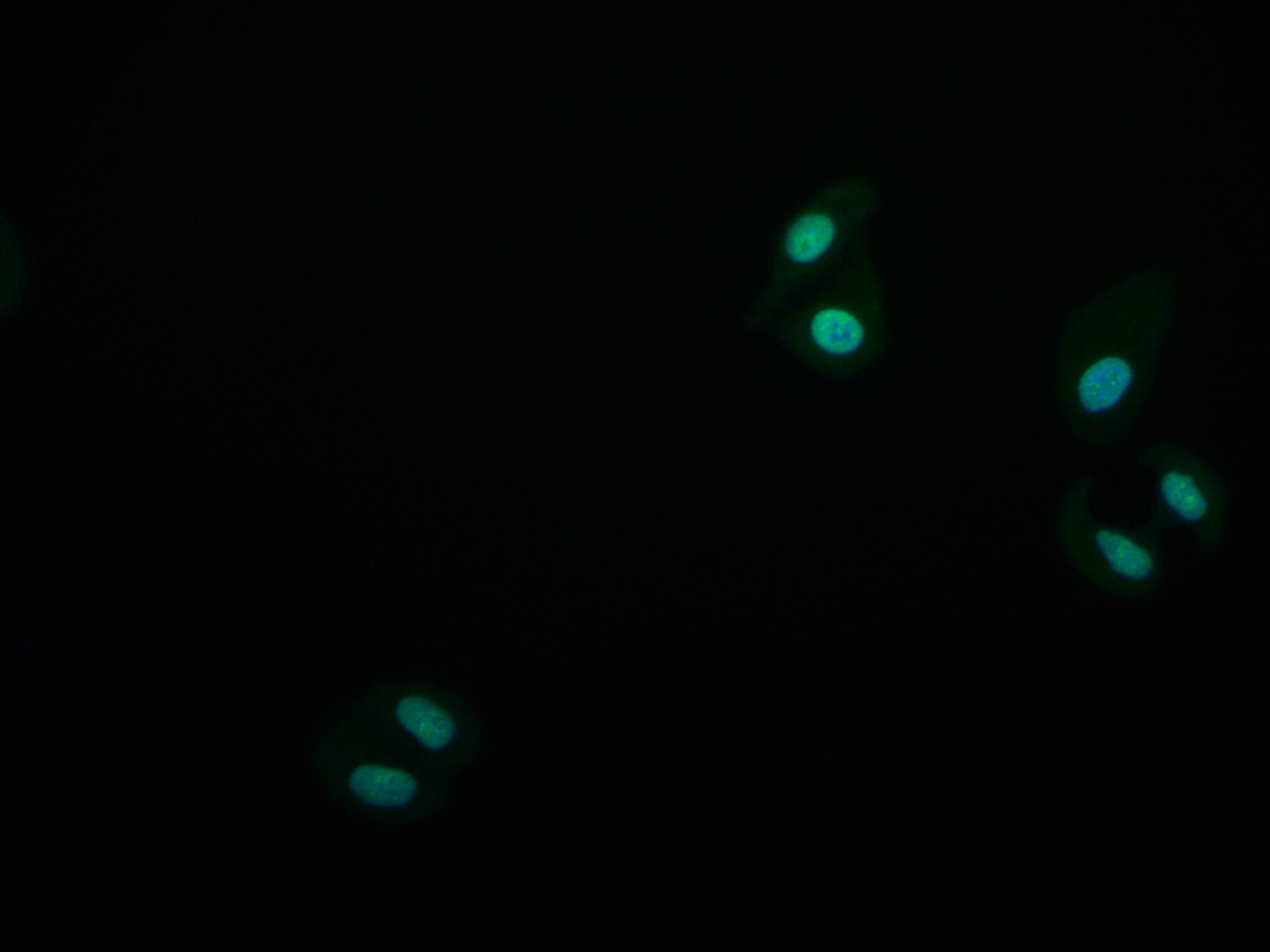 KAT8 Recombinant Monoclonal Antibody [7E11] (50µl)