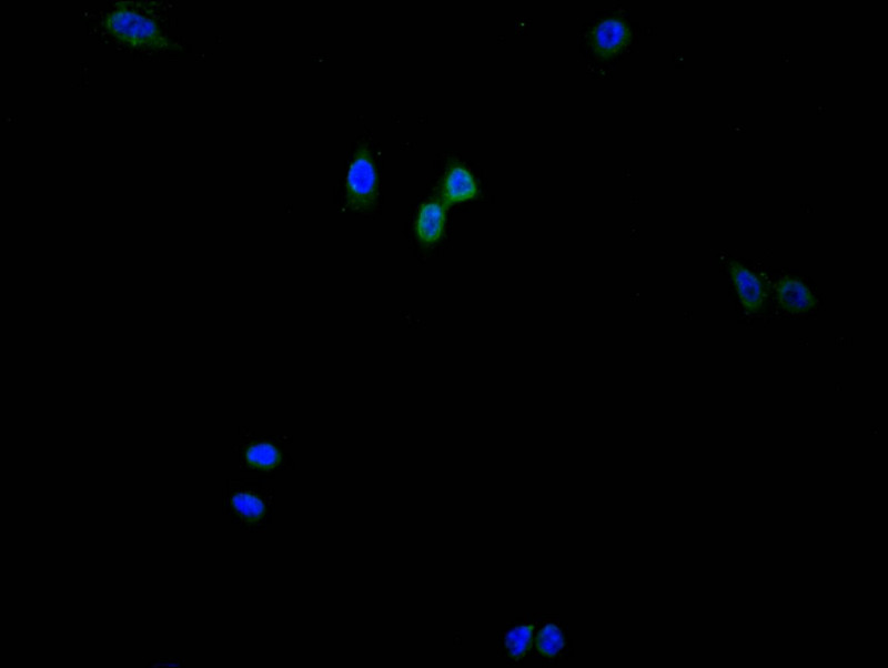HIST1H3A Recombinant Monoclonal Antibody [28H10] (50µl)