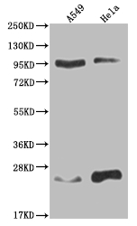 KDM1B Recombinant Monoclonal Antibody [15F3] (100µl)