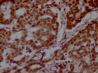 PARP1 Recombinant Monoclonal Antibody [7C11] (100µl)