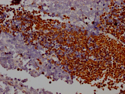 PARP1 Recombinant Monoclonal Antibody [5H8] (100µl)