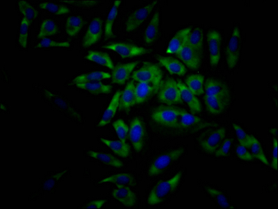 EIF4A1 Recombinant Monoclonal Antibody [7C3] (100µl)