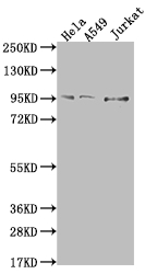 CARS Recombinant Monoclonal Antibody [8B11]