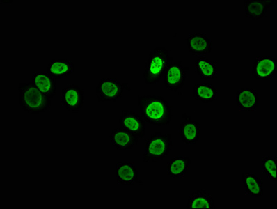 HNRNPK Recombinant Monoclonal Antibody [3G7] (100µl)
