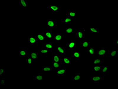 NONO Recombinant Monoclonal Antibody [8C11] (100µl)