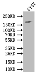 NCAM Recombinant Monoclonal Antibody [13F2] (100µl)