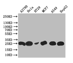 WFDC2 Recombinant Monoclonal Antibody [17D2] (100µl)
