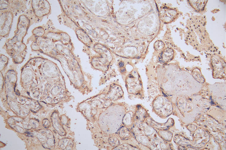 GAA Recombinant Monoclonal Antibody [5E5] (100µl)