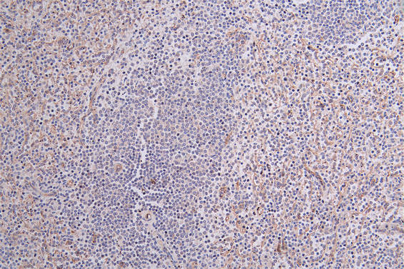 CD36 Recombinant Monoclonal Antibody [13B12]