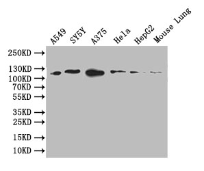 DDR2 Recombinant Monoclonal Antibody [9A9] (50µl)