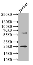 EBI3 Recombinant Monoclonal Antibody [12H5] (50µl)