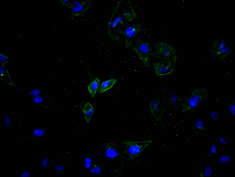 ATP7B Recombinant Monoclonal Antibody [24A4]