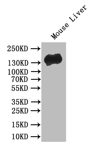 CDH1 Recombinant Monoclonal Antibody [30B12]