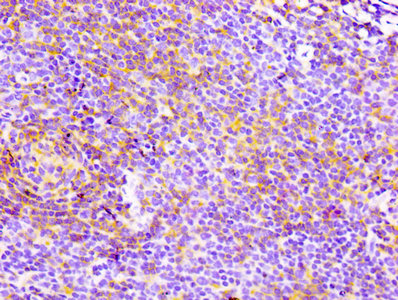 CD4 Recombinant Monoclonal Antibody [2B7] (50µl)