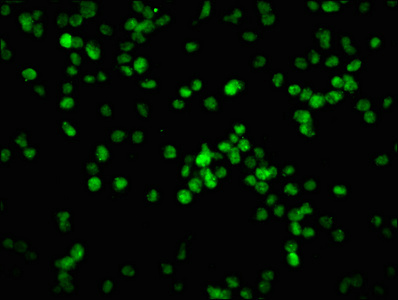 Phospho-RB1 (S780) Recombinant Monoclonal Antibody [2E9] (50µl)