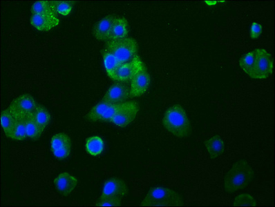 CCR9 Recombinant Monoclonal Antibody [4G2] (50µl)