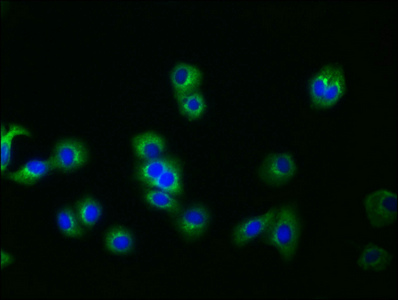 GPC3 Recombinant Monoclonal Antibody [4H11] (100µl)