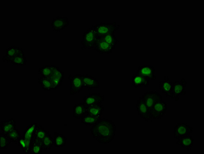 CDKN1B Recombinant Monoclonal Antibody [1G2] (100µl)