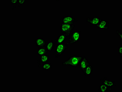 CDC25C Recombinant Monoclonal Antibody [3E6] (50µl)