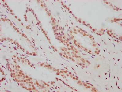 ARNT Recombinant Monoclonal Antibody [2F11] (50µl)