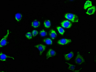 CD63 Recombinant Monoclonal Antibody [2E5]