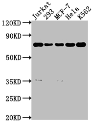 PTPN11 Recombinant Monoclonal Antibody [7A1] (50µl)