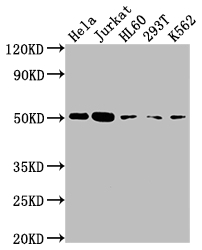 CASP2 Recombinant Monoclonal Antibody [7E5] (100µl)