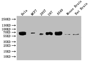 GBA Recombinant Monoclonal Antibody [4H4] (50µl)