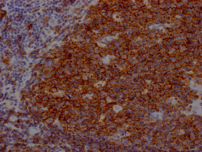 CD19 Recombinant Monoclonal Antibody [4C7]