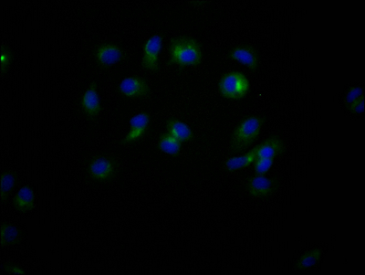 CD47 Recombinant Monoclonal Antibody [4G11] (50µl)