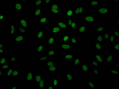 ALDOA Recombinant Monoclonal Antibody [7D8] (50µl)