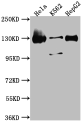 BUB1 Recombinant Monoclonal Antibody [9C11]