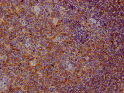 CD22 Recombinant Monoclonal Antibody [3D8] (50µl)