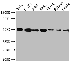 DRD3 Recombinant Monoclonal Antibody [5B10] (50µl)