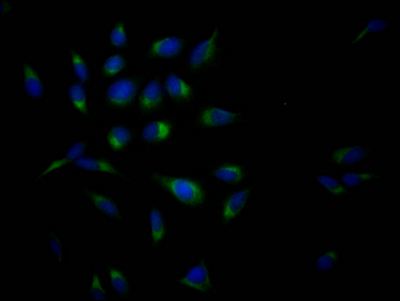 APP Recombinant Monoclonal Antibody [6F10] (50µl)