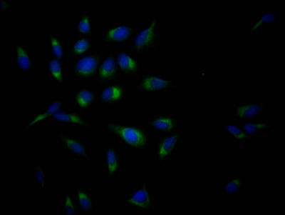 APP Recombinant Monoclonal Antibody [6F10]