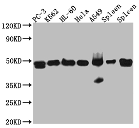 ACTR3 Recombinant Monoclonal Antibody [7E5] (50µl)