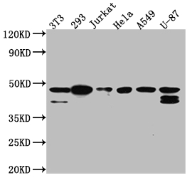 CSNK2A1 Recombinant Monoclonal Antibody [2B6] (100µl)