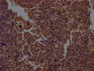 CASP2 Recombinant Monoclonal Antibody [3D4] (100µl)