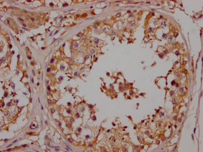 NGF Recombinant Monoclonal Antibody [5F10] (50µl)