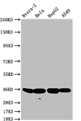 FGF19 Recombinant Monoclonal Antibody [11H3] (100µl)